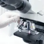 Rapporto colesterolo totale/HDL: calcolo e valori