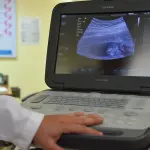 Ecografia 3D: costi e quando si fa nel 2026