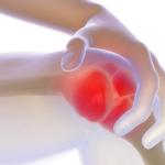 La gonartrosi, sintomi e come prevenirla